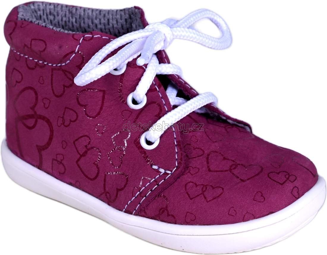 BOOTS4U T021 bordo potisk Velikost: 19