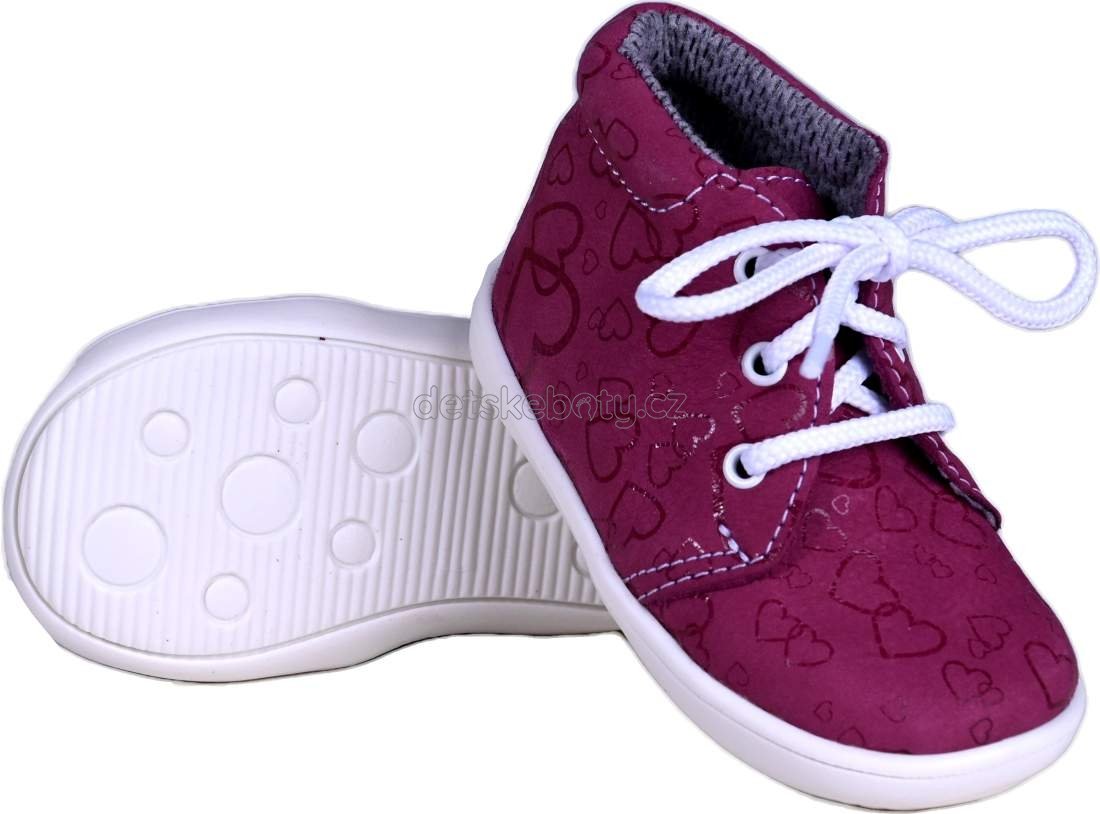 BOOTS4U T021 bordo potisk Velikost: 19
